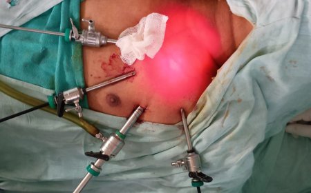 एम वाय मेंजटिल एंडोस्कोपिक थायराडेक्टमी नामक सर्जरी कर बचाई  मरीज की जान