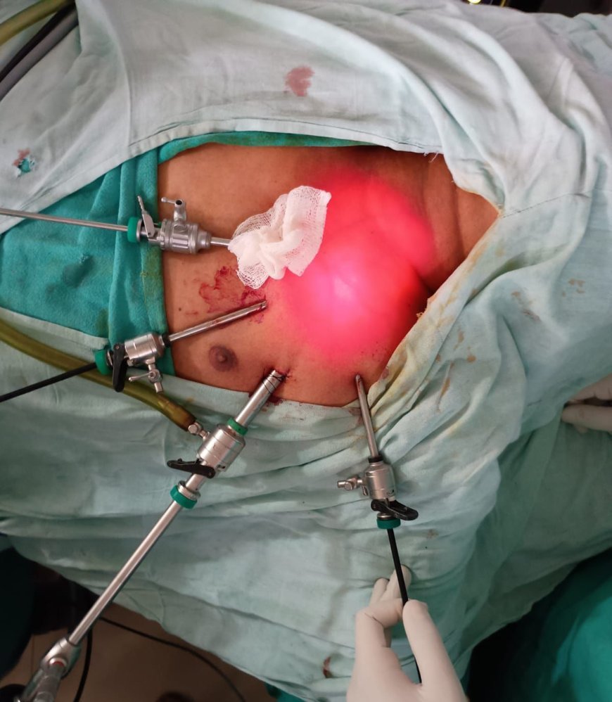 एम वाय मेंजटिल एंडोस्कोपिक थायराडेक्टमी नामक सर्जरी कर बचाई  मरीज की जान