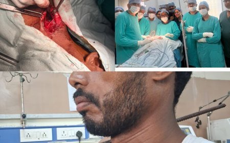 एमवाय अस्पताल में सफल ऑपरेशन - लोहे का सरिया गले में घुसने के बावजूद युवक की बचाई जान