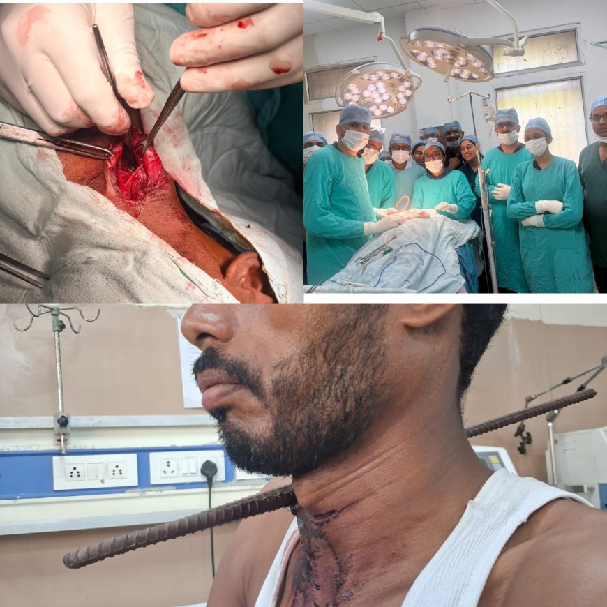 एमवाय अस्पताल में सफल ऑपरेशन - लोहे का सरिया गले में घुसने के बावजूद युवक की बचाई जान